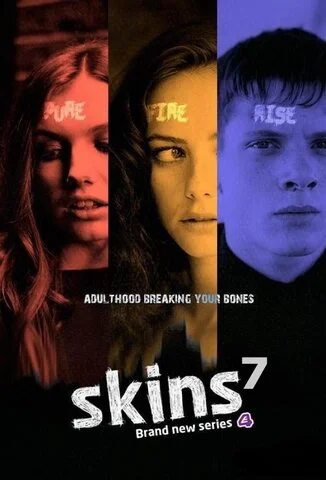 Skins UK